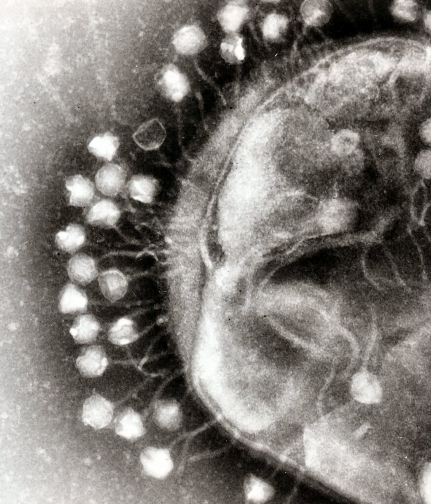 Transmission electron micrograph of multiple bacteriophages attached to a bacterial cell wall; the magnification is approximately 200,000.