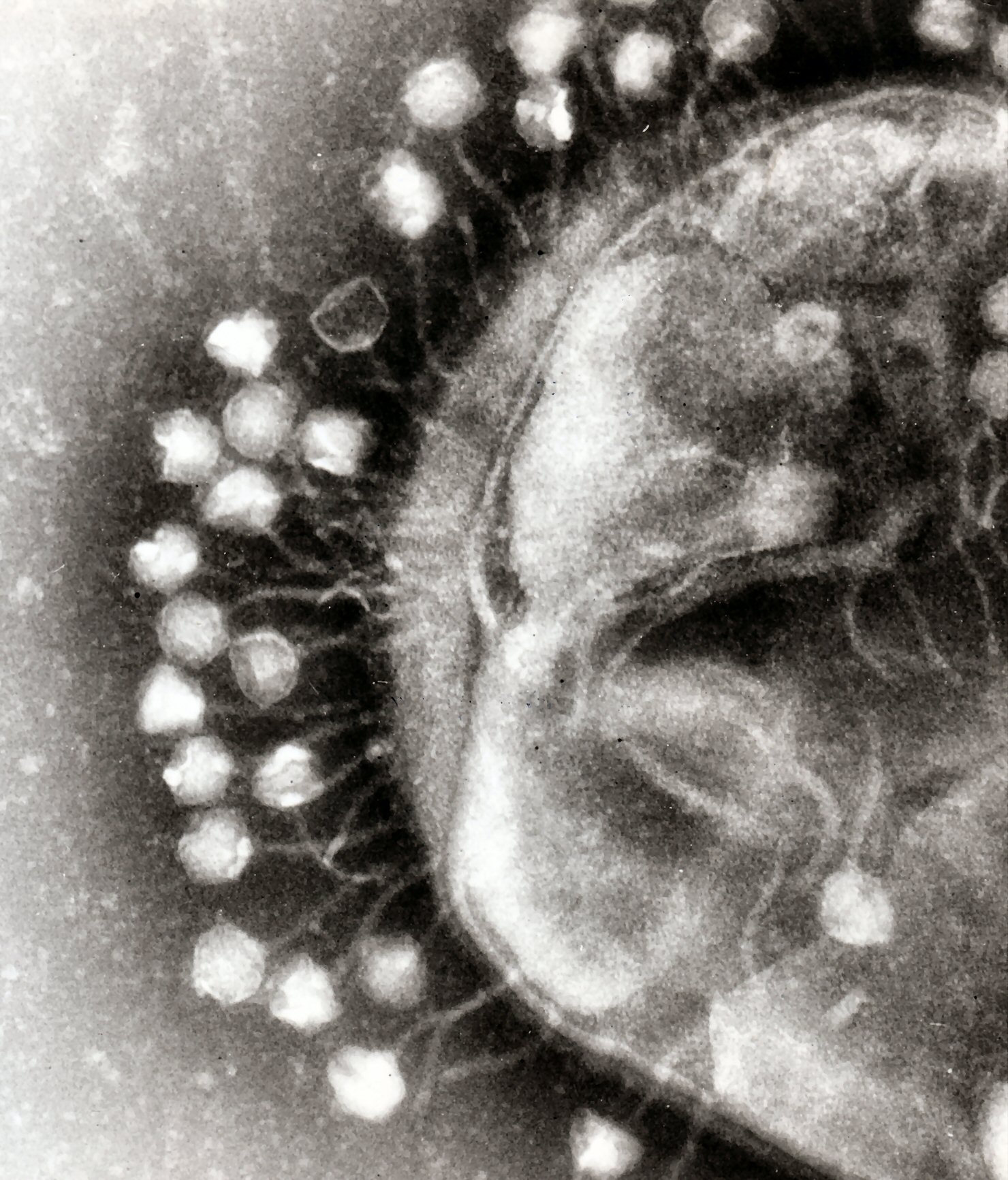 Transmission electron micrograph of multiple bacteriophages attached to a bacterial cell wall; the magnification is approximately 200,000.
